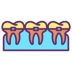 Braces