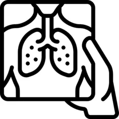 X ray