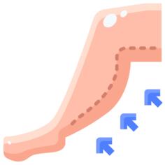 Liposuction