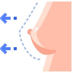 乳房