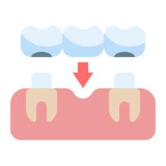 王冠