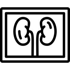 X ray