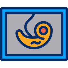 Ultrasound