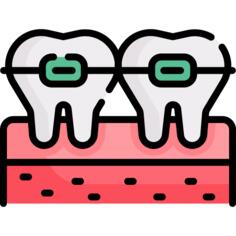 Braces
