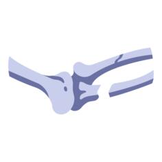 Broken bone