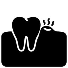 Gingivitis