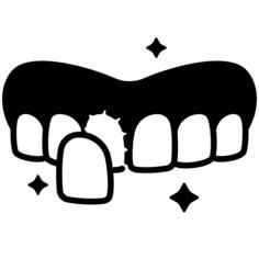 Dental veneer