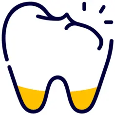 Broken tooth