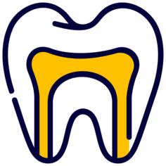 Root canal