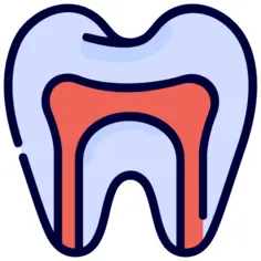 Root canal
