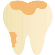 Cavity