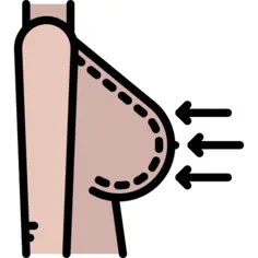 Breast