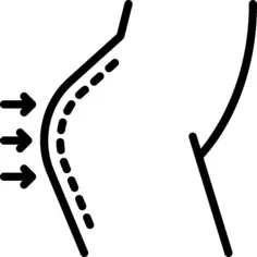 Gluteus