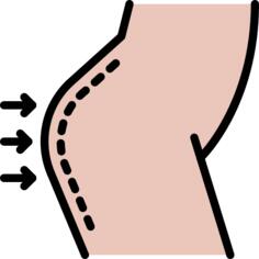 Gluteus