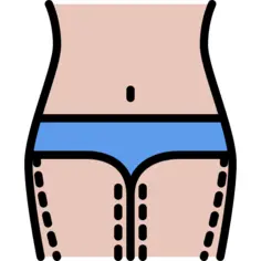 Liposuction