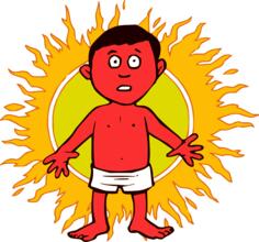 Sunburned man