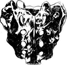 Sacral bone