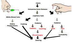 Inflammation scheme vector image