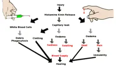 Inflammation scheme vector image